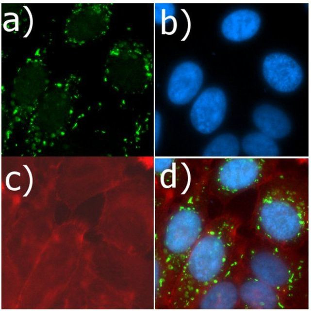 mTOR Antibody in Immunocytochemistry (ICC/IF)