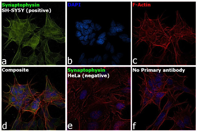 Synaptophysin Antibody