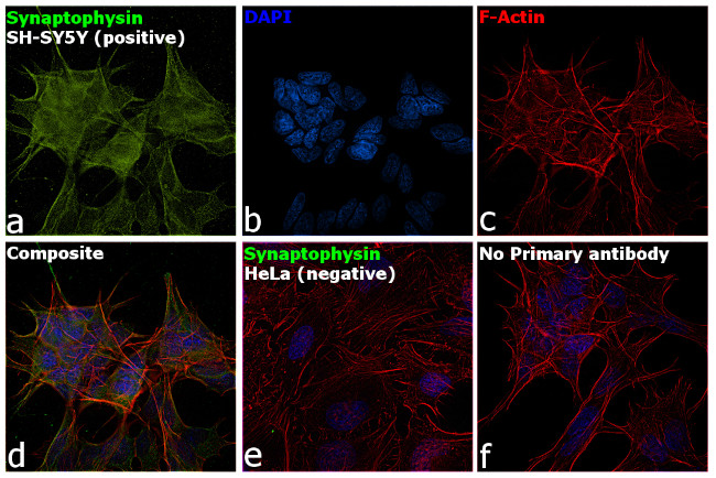 Synaptophysin Antibody in Immunocytochemistry (ICC/IF)