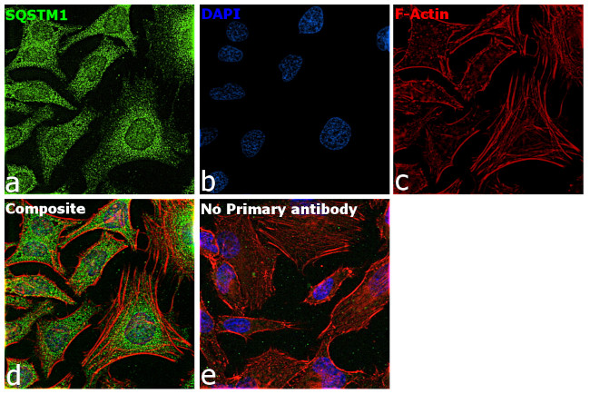 SQSTM1 Antibody in Immunocytochemistry (ICC/IF)