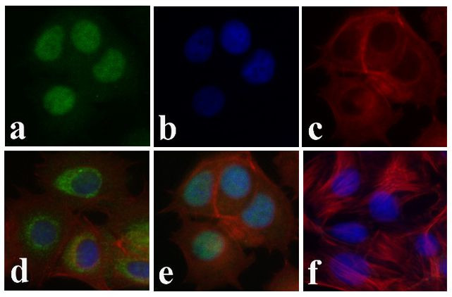 Phospho-SMAD2 (Ser465, Ser467) Antibody in Immunocytochemistry (ICC/IF)