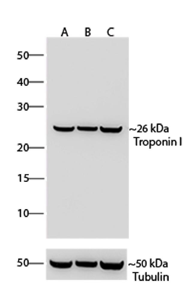 Troponin I Antibody in Western Blot (WB)