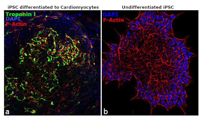 Troponin I Antibody in Immunocytochemistry (ICC/IF)