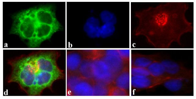 DYKDDDDK Tag Antibody in Immunocytochemistry (ICC/IF)