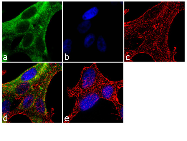 PSA Antibody in Immunocytochemistry (ICC/IF)