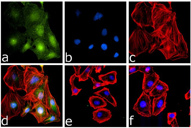 Phospho-IKK alpha/beta (Ser176, Ser180) Antibody in Immunocytochemistry (ICC/IF)