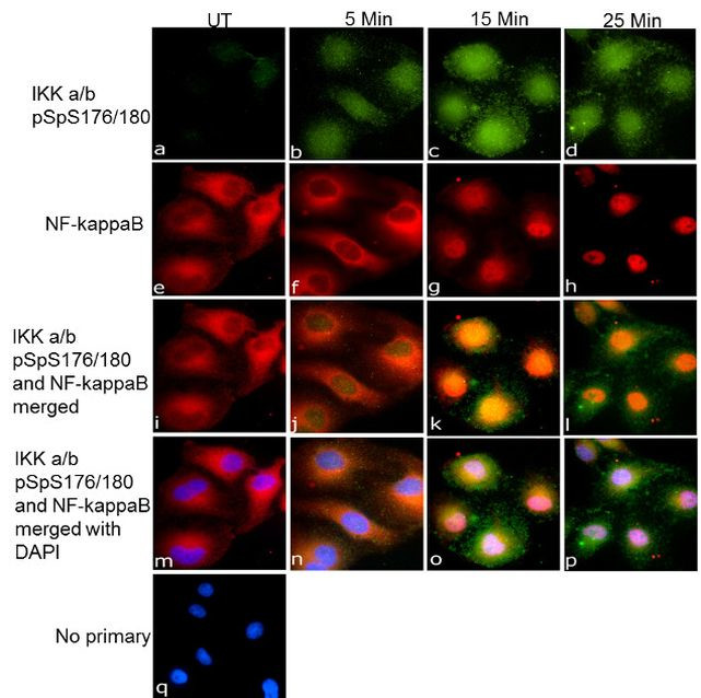 Phospho-IKK alpha/beta (Ser176, Ser180) Antibody in Immunocytochemistry (ICC/IF)