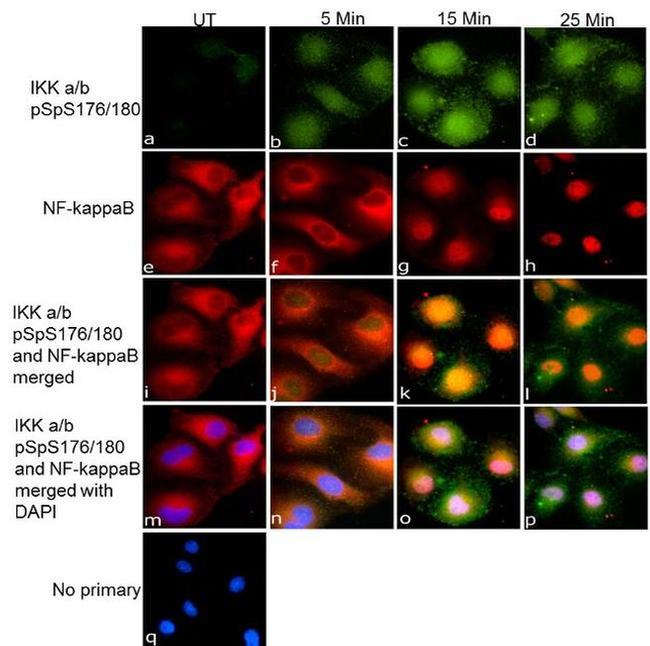 Phospho-IKK alpha/beta (Ser176, Ser180) Antibody