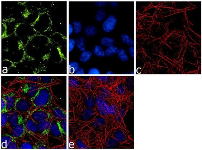 Huntingtin Antibody in Immunocytochemistry (ICC/IF)