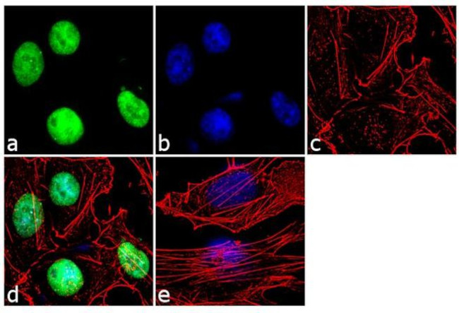 SALL4 Antibody in Immunocytochemistry (ICC/IF)