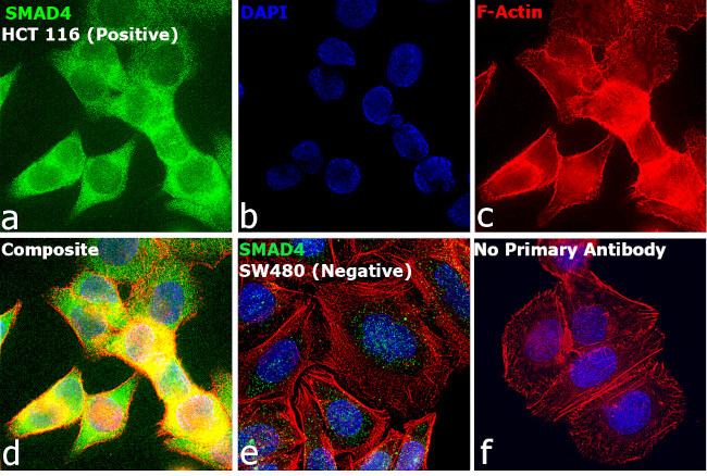 SMAD4 Antibody in Immunocytochemistry (ICC/IF)