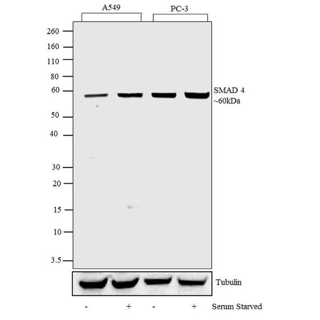 SMAD4 Antibody in Western Blot (WB)