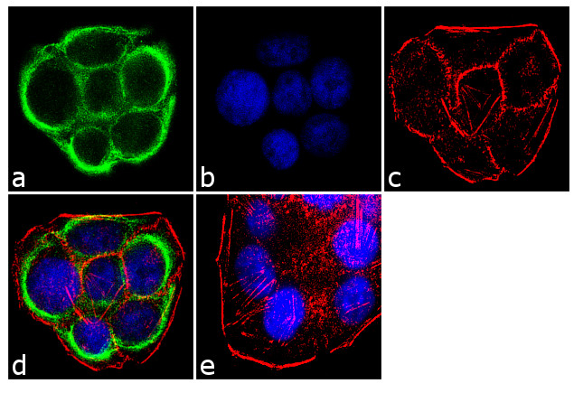 TGFBR2 Antibody in Immunocytochemistry (ICC/IF)