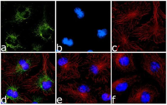 BNIP3 Antibody in Immunocytochemistry (ICC/IF)