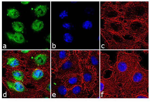 Phospho-CHK2 (Thr387) Antibody in Immunocytochemistry (ICC/IF)