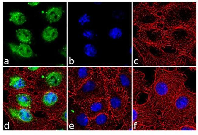 Phospho-CHK2 (Thr387) Antibody