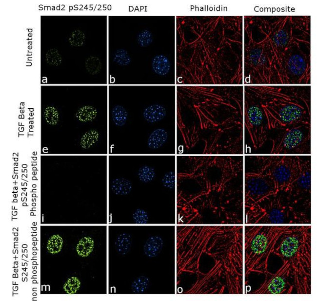 Phospho-SMAD2 (Ser245, Ser250) Antibody in Immunocytochemistry (ICC/IF)
