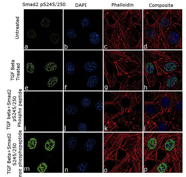 Phospho-SMAD2 (Ser245, Ser250) Antibody