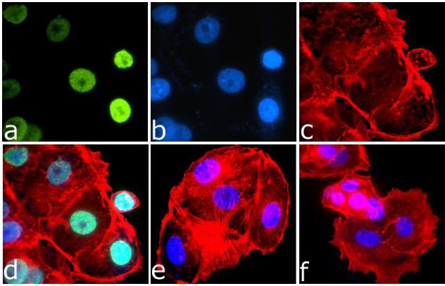 Phospho-IRS1 (Ser616) Antibody in Immunocytochemistry (ICC/IF)