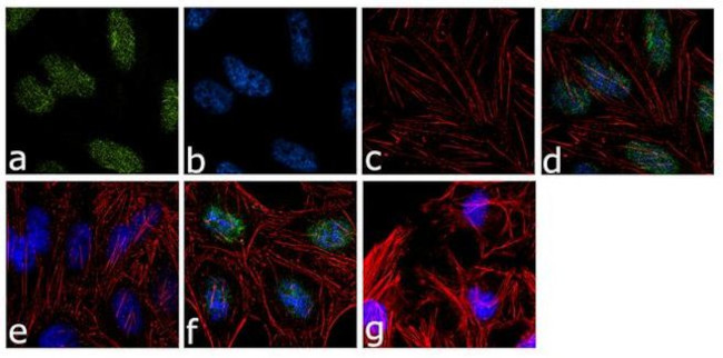 H3K79me2 Antibody in Immunocytochemistry (ICC/IF)