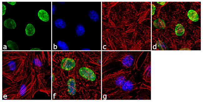 H3K9me2 Antibody in Immunocytochemistry (ICC/IF)