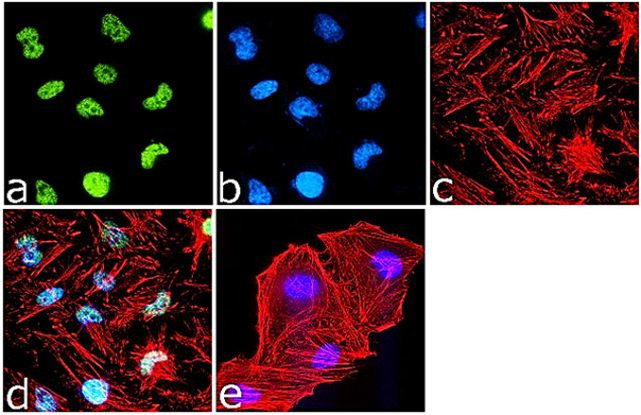 H4K12ac Antibody in Immunocytochemistry (ICC/IF)