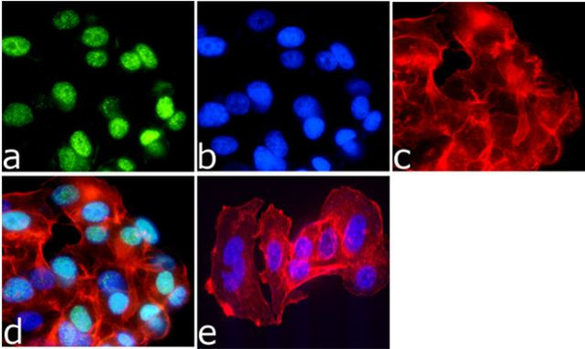 H2BK15ac Antibody in Immunocytochemistry (ICC/IF)