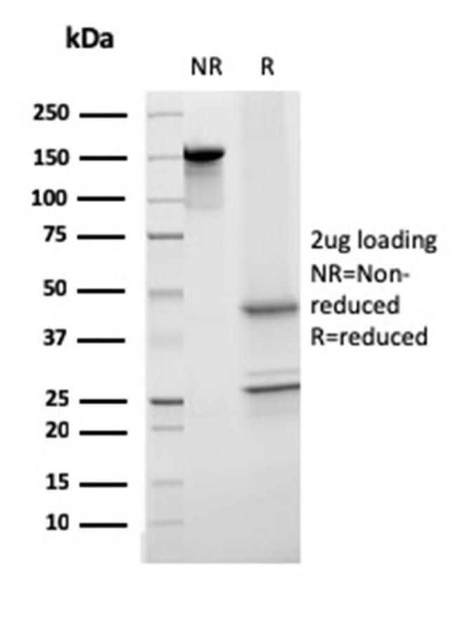 Transferrin Antibody in SDS-PAGE (SDS-PAGE)