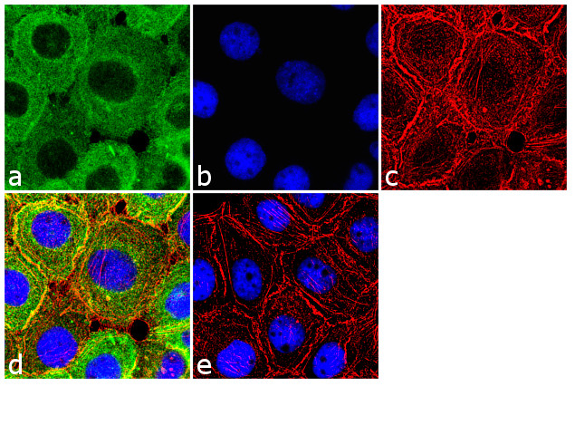 Kindlin Antibody in Immunocytochemistry (ICC/IF)