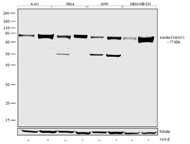 Kindlin Antibody in Western Blot (WB)