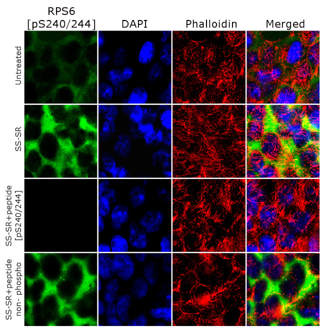 Phospho-S6 (Ser240, Ser244) Antibody in Immunocytochemistry (ICC/IF)