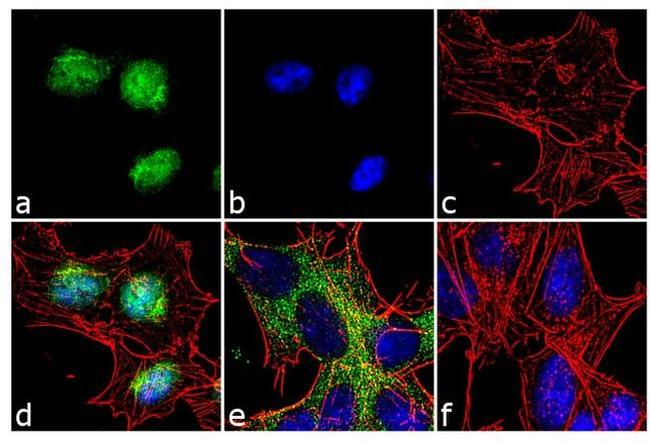 FOXO3A Antibody