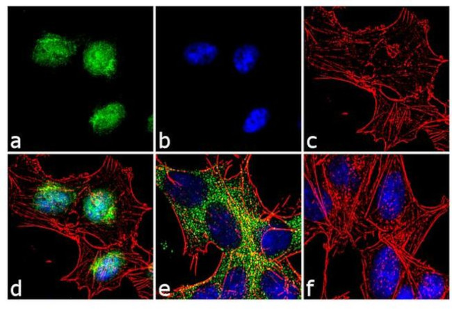 FOXO3A Antibody in Immunocytochemistry (ICC/IF)