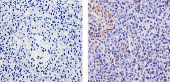 WNT2B Antibody in Immunohistochemistry (Paraffin) (IHC (P))