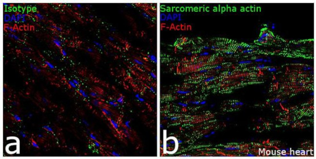 alpha Actinin 2 Antibody in Immunohistochemistry (Frozen) (IHC (F))