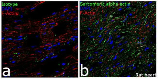 alpha Actinin 2 Antibody in Immunohistochemistry (Frozen) (IHC (F))