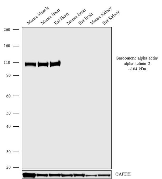 alpha Actinin 2 Antibody