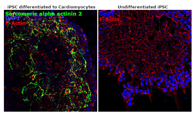 alpha Actinin 2 Antibody in Immunocytochemistry (ICC/IF)