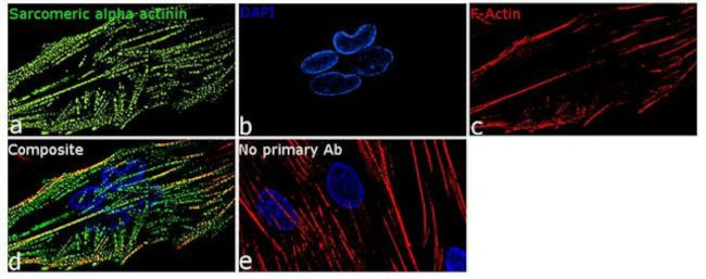 alpha Actinin 2 Antibody in Immunocytochemistry (ICC/IF)