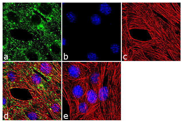 Sca-1 Antibody in Immunocytochemistry (ICC/IF)