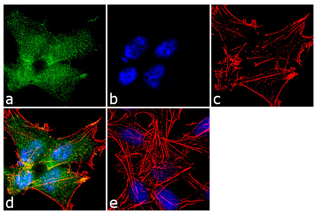 Somatostatin Antibody in Immunocytochemistry (ICC/IF)