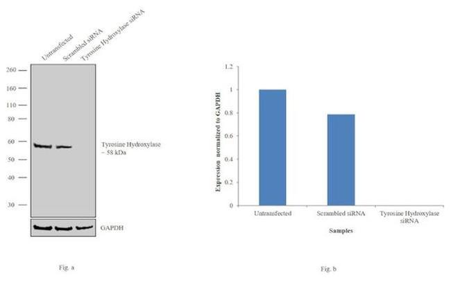 Tyrosine Hydroxylase Antibody in Western Blot (WB)