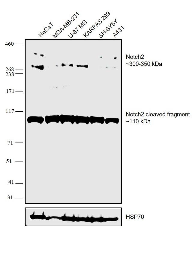 NOTCH2 Antibody in Western Blot (WB)