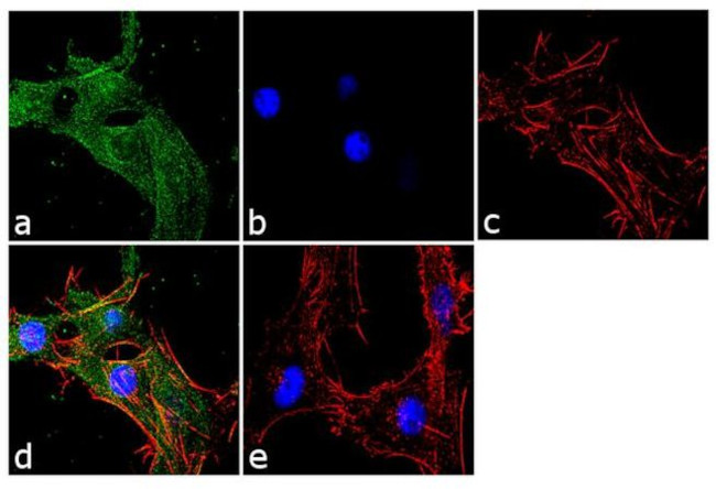 GLT-1 Antibody in Immunocytochemistry (ICC/IF)