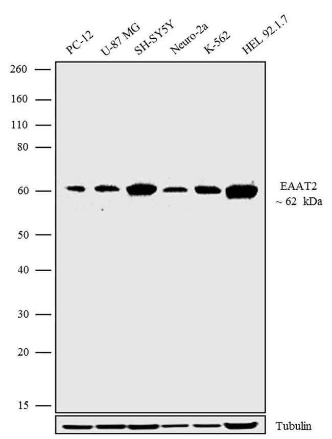 GLT-1 Antibody in Western Blot (WB)