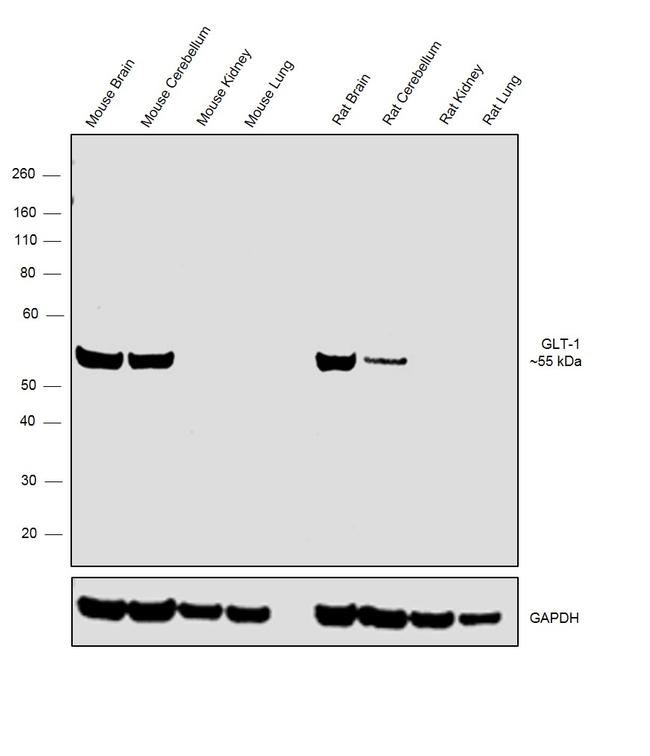 GLT-1 Antibody in Western Blot (WB)