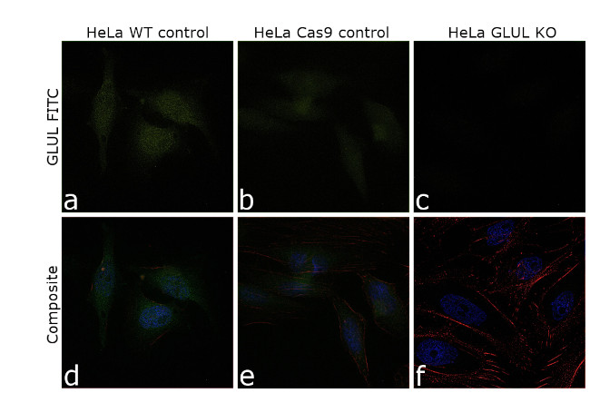 Glutamine Synthetase Antibody