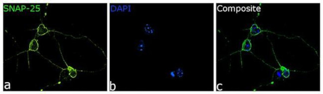 SNAP25 Antibody in Immunocytochemistry (ICC/IF)