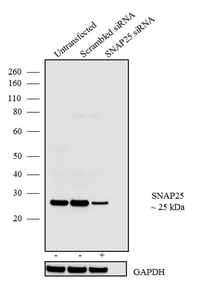 SNAP25 Antibody in Western Blot (WB)