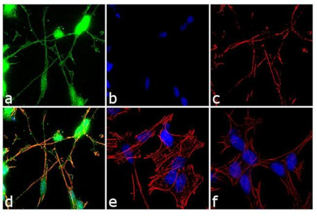 NF-H Antibody in Immunocytochemistry (ICC/IF)